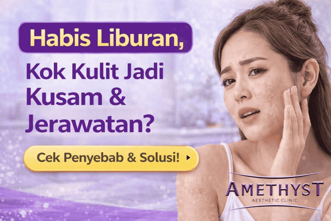 kulit kusam setelah liburan jerawatan mengelupas