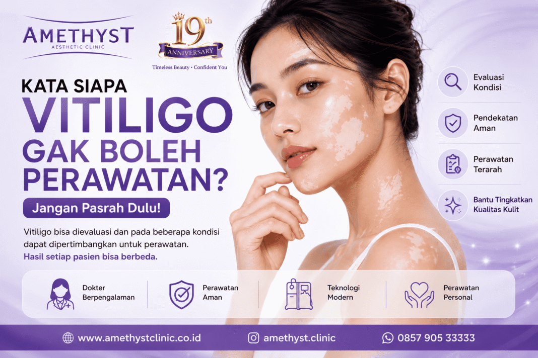 Perawatan vitiligo Surabaya untuk bercak putih kulit di Amethyst Aesthetic Clinic